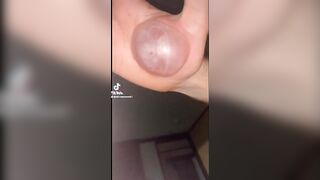 BLISTER POPPING