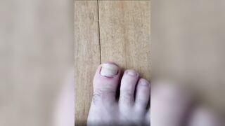 Pulling off an ingrown toenail.