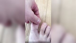 Make Me Suffer More: Pulling off an ingrown toenail. #3